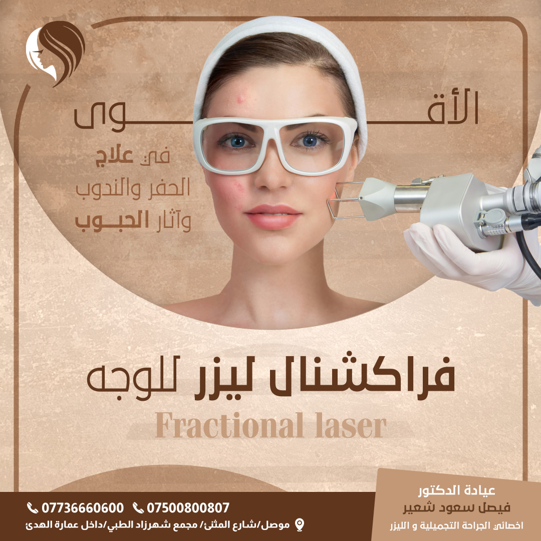 فراكشنال ليزر