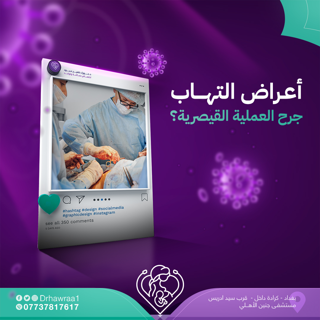 اعراض التهاب
